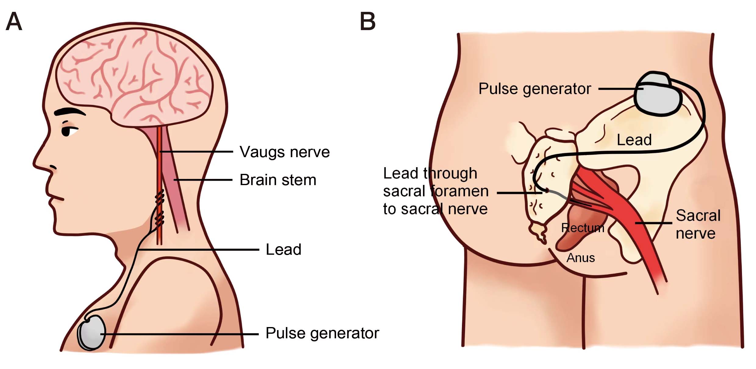 The Role of Vagus Nerve Stimulation (Simple, Non Invasive Methods) (4)